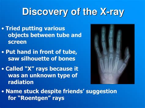 Ppt How Do X Rays Work Powerpoint Presentation Free Download Id