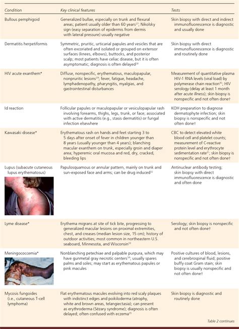 Table 3 From The Generalized Rash Part I Differential Diagnosis