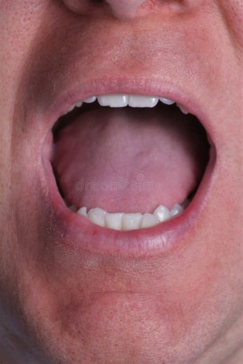 Male Open Mouth With Teeth And Tongue Stock Photo Image Of Hygiene