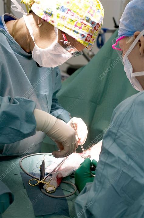 Hernia Surgery Stock Image M5510542 Science Photo Library