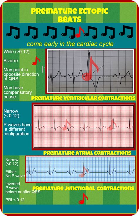 Premature Ectopic Beats Ekg Rhythms Nursing