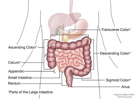 Understanding Your Pathology Report Colon Cancer Oncolink