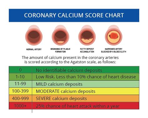 Calcium Score