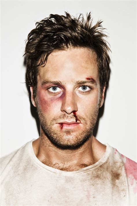 Armie hammer is being hit with more bad news amid the sexual assault allegations that he is facing. Armie Hammer bloodied, bruised and beaten in 'Men's Health ...