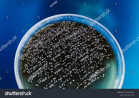 White Colony Candida Albicans Colonies Candida Stock Photo 2102635924