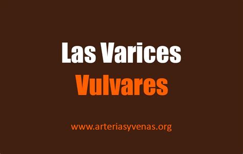 Varices Vulvares Arterias Y Venas