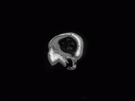 Mri Brain Scan GIF Medicine MRI Brain Discover Share GIFs