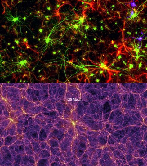 Human Brains Neuronal Network Has Similarities To Cosmic Web Study