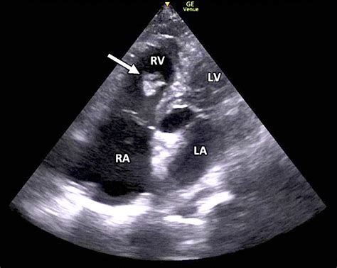 Heart Ultrasound Images Overview Aims Fetal Heart Assessment Go