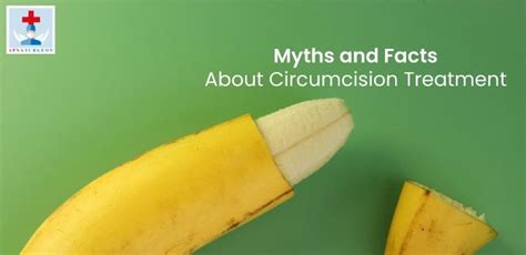 myths and facts about circumcision treatment apnasurgeon medium