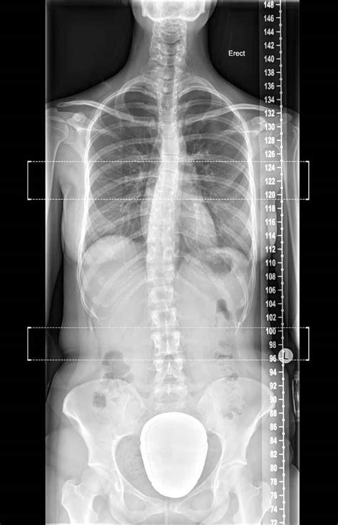 Digital X Ray Diagnostic Imaging Melbourne Radiology