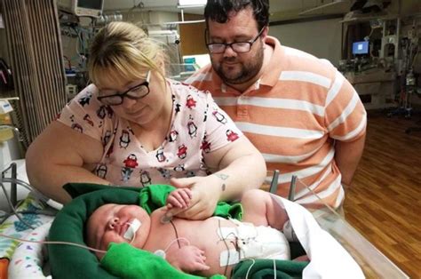 Baby Born Weighing 14 Pounds 13 Ounces Smashes Hospital Record Daily Star