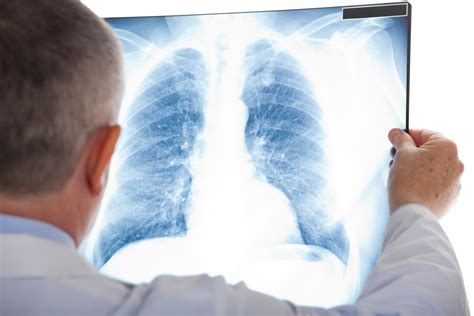 Your First Pulmonology Appointment What To Expect Santiam Medical
