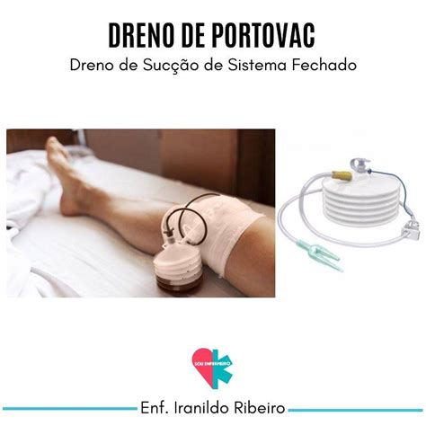 Dreno De Sucção Sanfonado