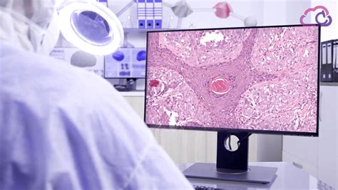 La Patología Digital Como Herramienta Para Facilitar El Diagnóstico De