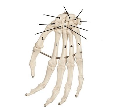 Metacarpal bones: