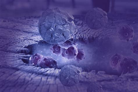 Digital Illustration Of Cancer Cells In Human Body Stock Photo