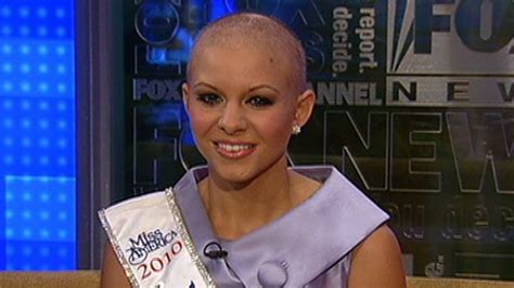 Bald Beauty Queen Captures Crown Fox News Video