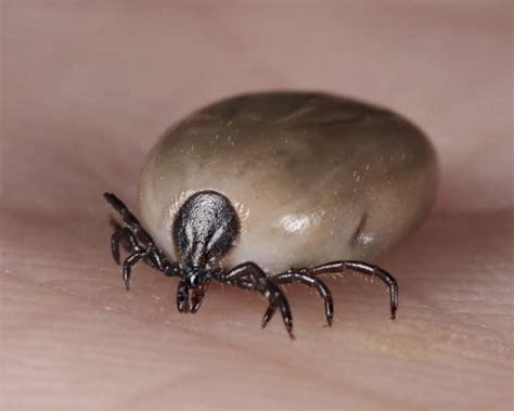 Rare Case Of Tick Paralysis Left A 5 Year Old Girl Temporarily Unable