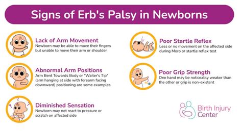 Erb S Palsy Symptoms Birth Injury Center