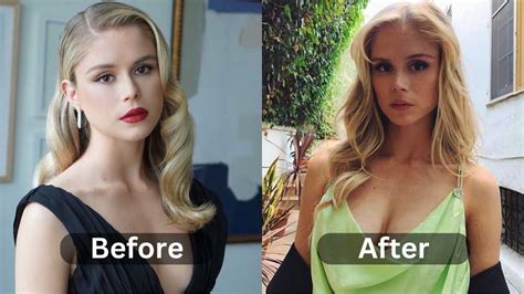 Erin Moriarty Plastic Surgery Before After Myth Or Reality Weight Loss