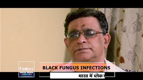 Black Fungus Infections Focus Social Media Youtube