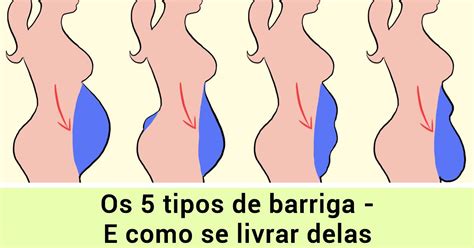 O Que Significa Barriga D'água