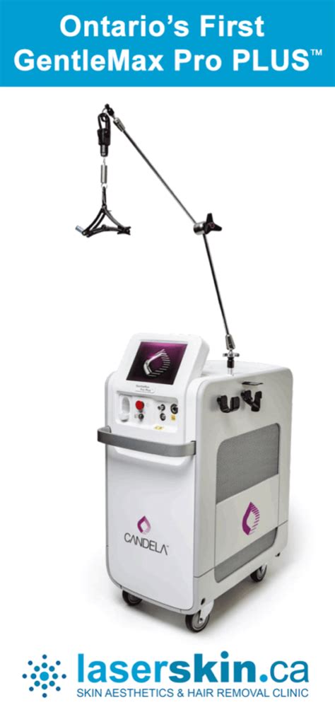 Gentlemax Pro Plus Laser Welcome To Laser Wellness And Trichology Centre