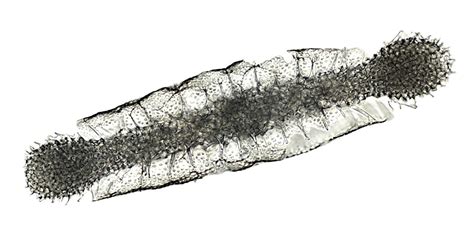 Ssm Spongocore South China Sea Picture Of Radiolarian Microscopic