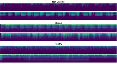 Examples Of The Mel Spectrograms For The Chronic Non Chronic And