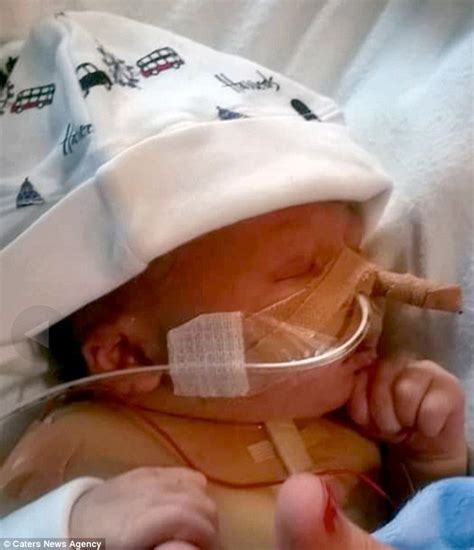 Baby Given Handmade Heart After Undergoing Open Heart Surgery At