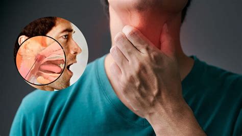 Throat Cancer 6 Unusual Symptoms Of Larynx Cancer That May Show Up In Other Body Parts