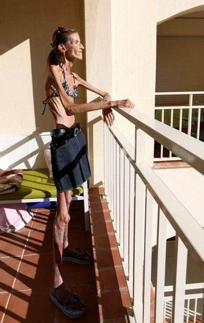 Valeria Levitin One Of The Skinniest Woman In The World Sideshow Freaks