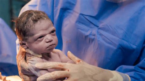 Photo Shows Baby Glaring At Doctors In Stare Down Moments After Her