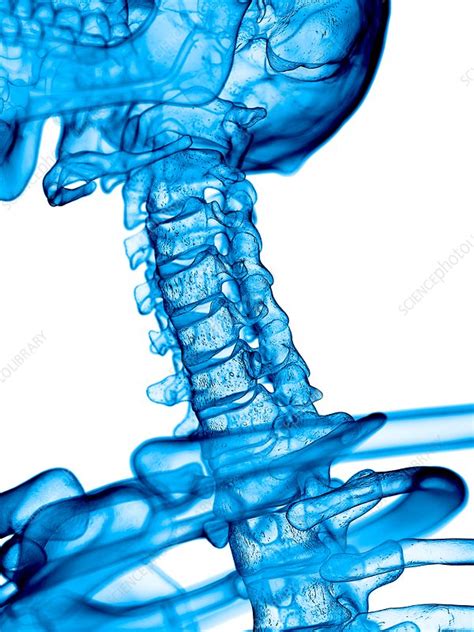 Human Cervical Spine Stock Image F0163324 Science Photo Library