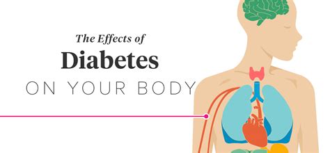 What Physical Problems Does Diabetes Cause Diabeteswalls