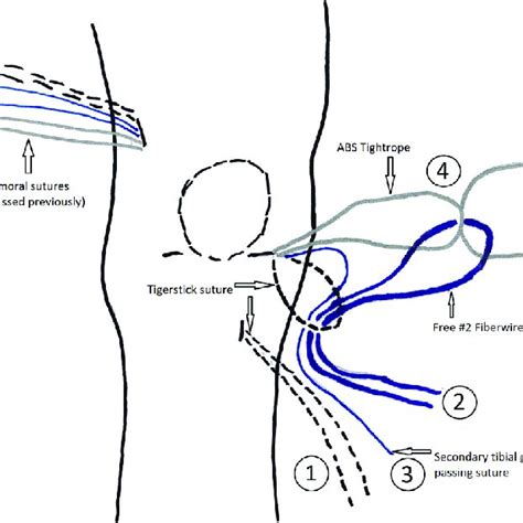 Right Knee Medial Is On Right And Superior Is At Top Of Image With