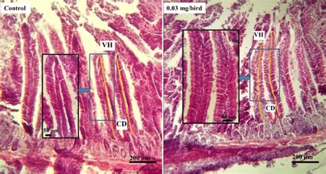 Histological Representation Of Duodenal Mucosa Of Control And 003