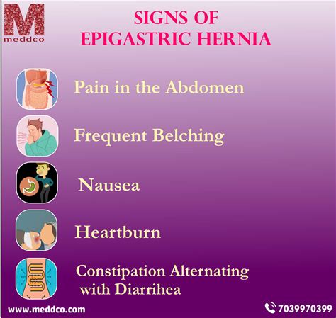 Epigastric Hernia Umbilical Hernia Abdominal Pain Stomach Ulcers