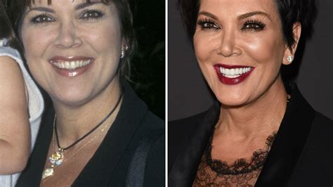 Beauty Wahn Extrem So Sah Kris Jenner Vor 16 Jahren Aus Promiflashde