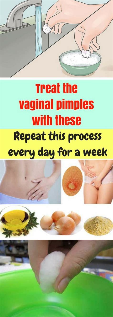 let start slim today treat the vaginal pimples with these natural remedies
