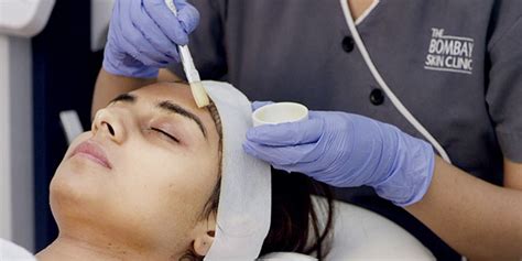 Chemical Peel Treatment Types Procedure Expected Results Side