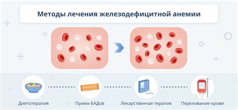 Железодефицитная анемия: симптомы, причины и методы лечения Картинка - Железодефицитная анемия: симптомы, причины и методы лечения