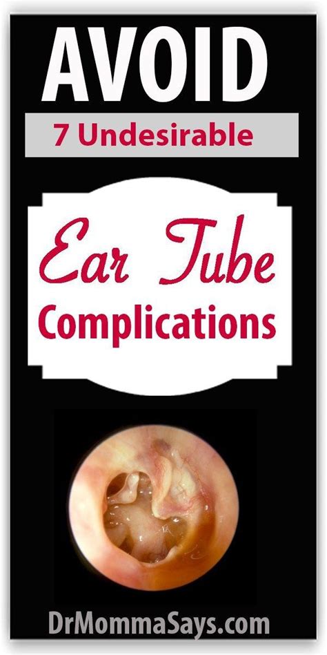 Ear L Tube L Infection L Ear Fluid L Ear Tube Problems L Hearing Loss L