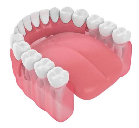 Partial Denture Stock Photos Royalty Free Partial Denture Images