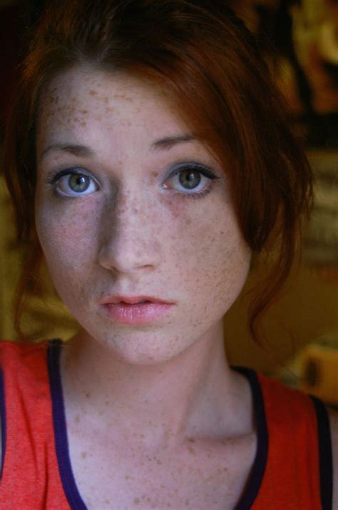 All Over Freckles Darker Contrast To Pale Skin Beautiful Red Hair