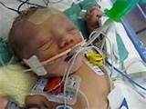 What Causes Gas In Newborns Images