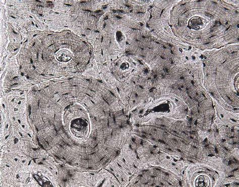 The osteon consists of a central canal called the osteonic (haversian) canal, which is surrounded by concentric rings (lamellae) of matrix. SIU SOM Histology SSB