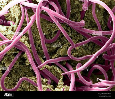 Threadworms In Intestine Coloured Scanning Electron Micrograph Sem