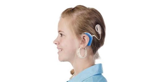 Cochlear Implants 9 Things Doctors Want You To Know